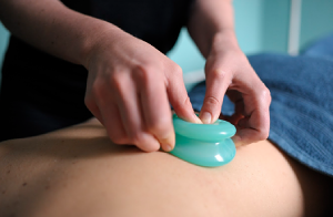Cupping behandeling bij Relaxed met Roos